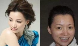 爆料娱乐圈整容内幕,明星整容背后的惊人内幕